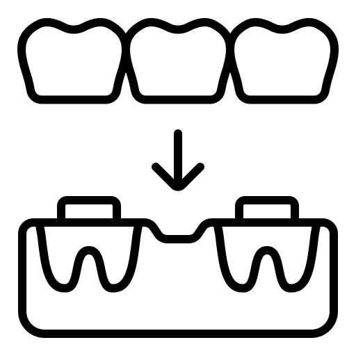 Dental Bridge 1