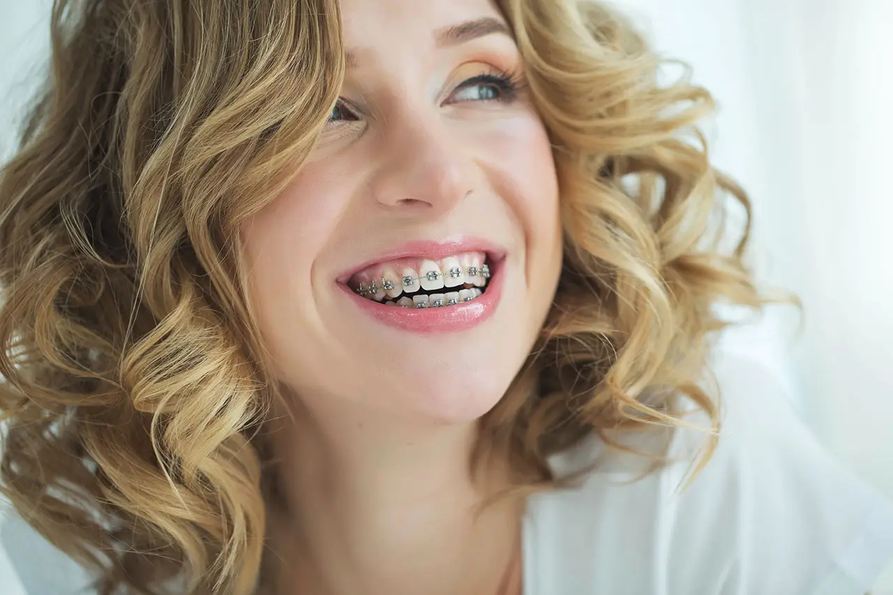 Braces in Santa Ana, CA